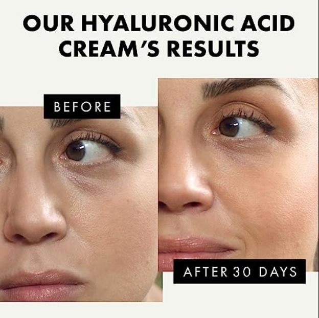 Crème à l'acide hyaluronique biologique  avec rétinol pour le visage - vitamines C et E -  3X PLUS EFFICACE avec 2% d'AH - Crème hydratante anti-âge + Rétinol Hydrate et raffermit jour et nuit - VEGAN / DÉVELOPPÉ PAR UN DERMATOLOGUE